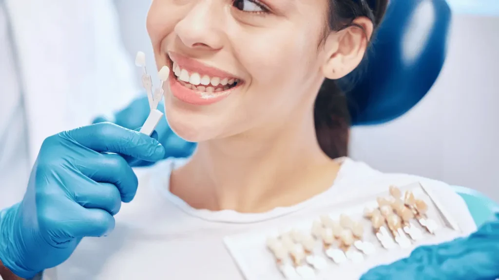 Dental Veneers